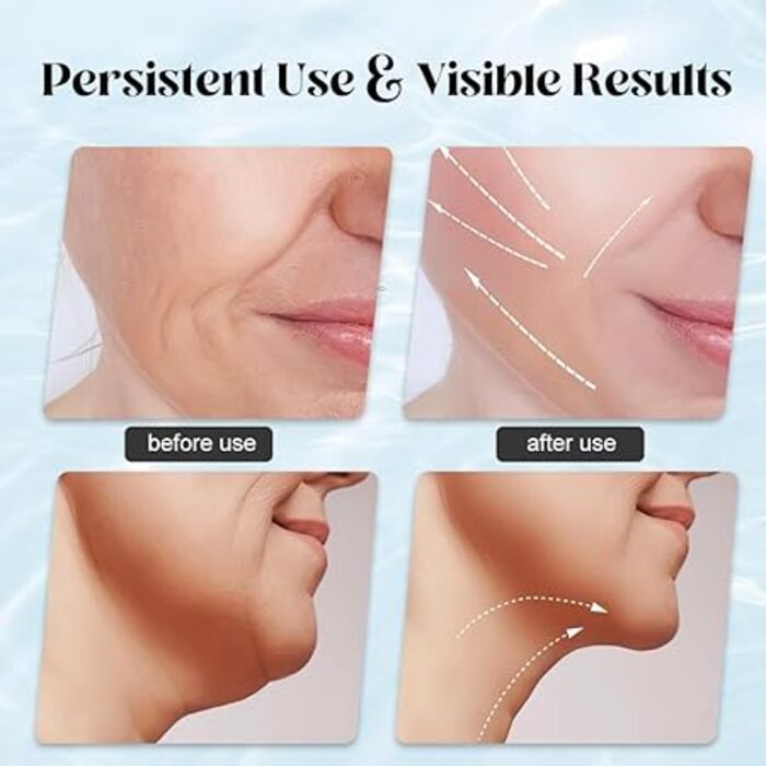 LED Neck Lifting Device
