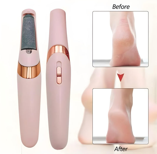 Electric Foot File Callus Remover